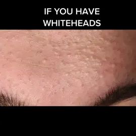 TikTok video