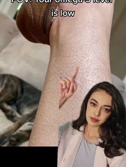TikTok video